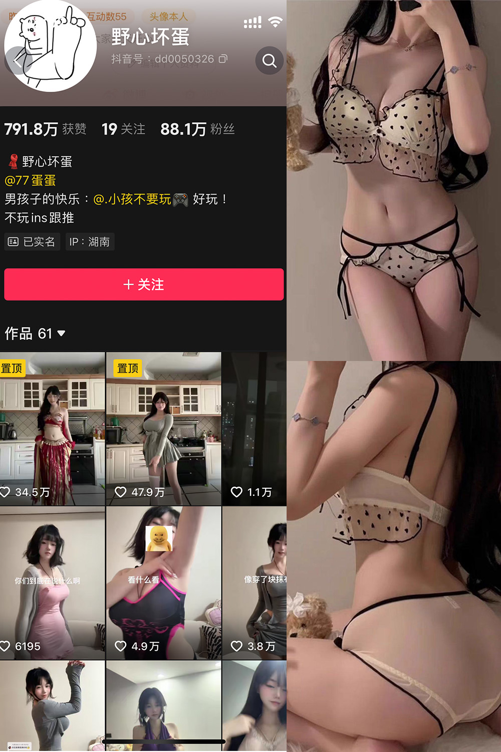 抖音 野心坏蛋 微密圈  NO.007期 【13P】最新至：2025.1.14-草莓酱